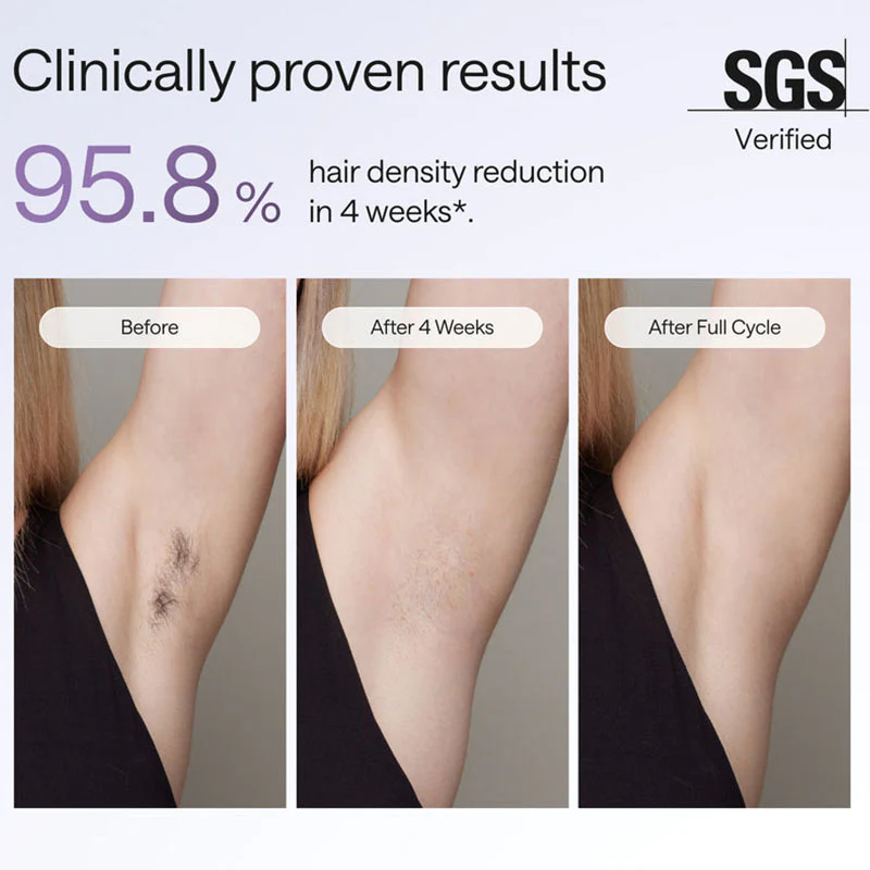 Laser Hair Removal Device