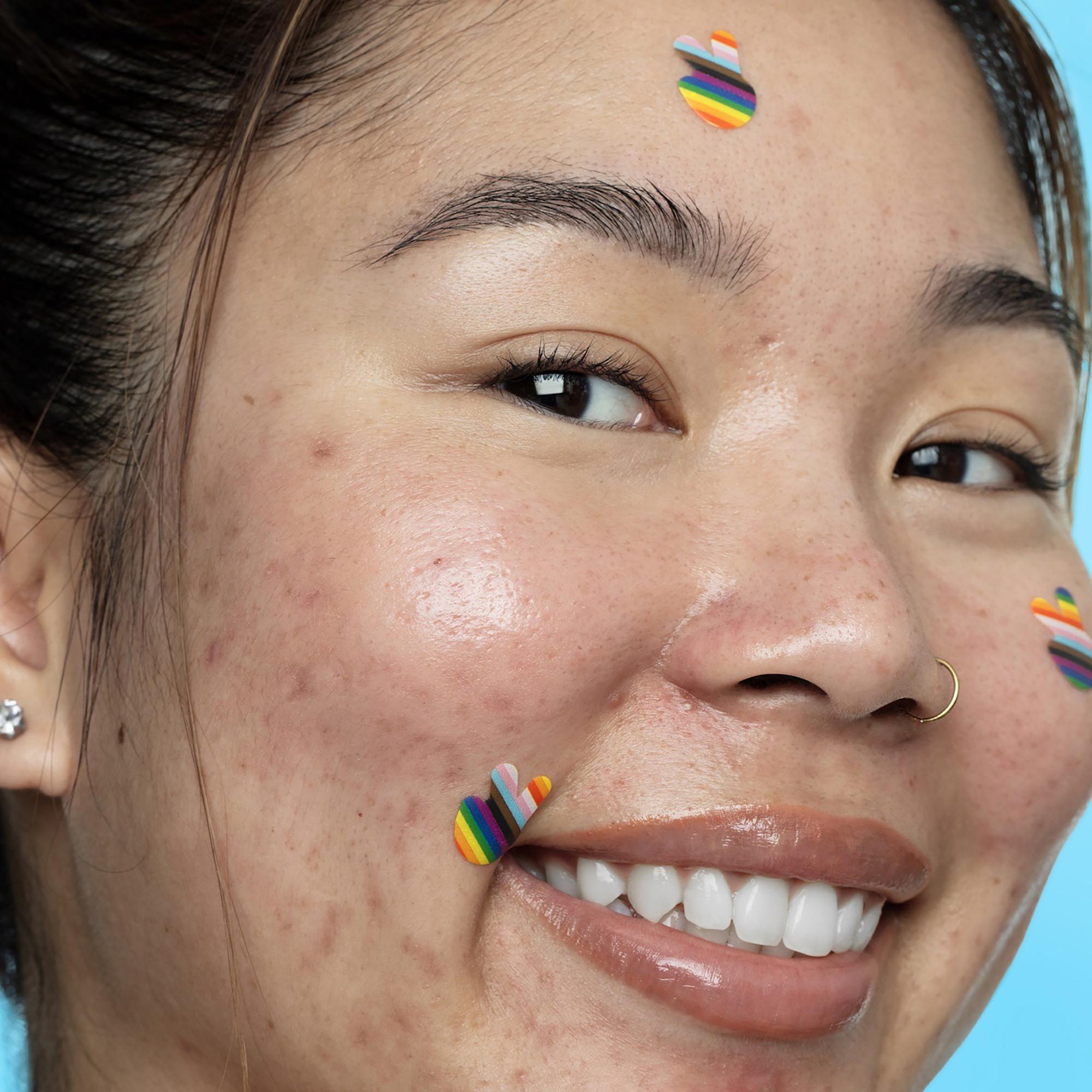 PEACE OUT SKINCARE Pride Limited Edition-Patches für Aknebehandlung mit Salicylsäure