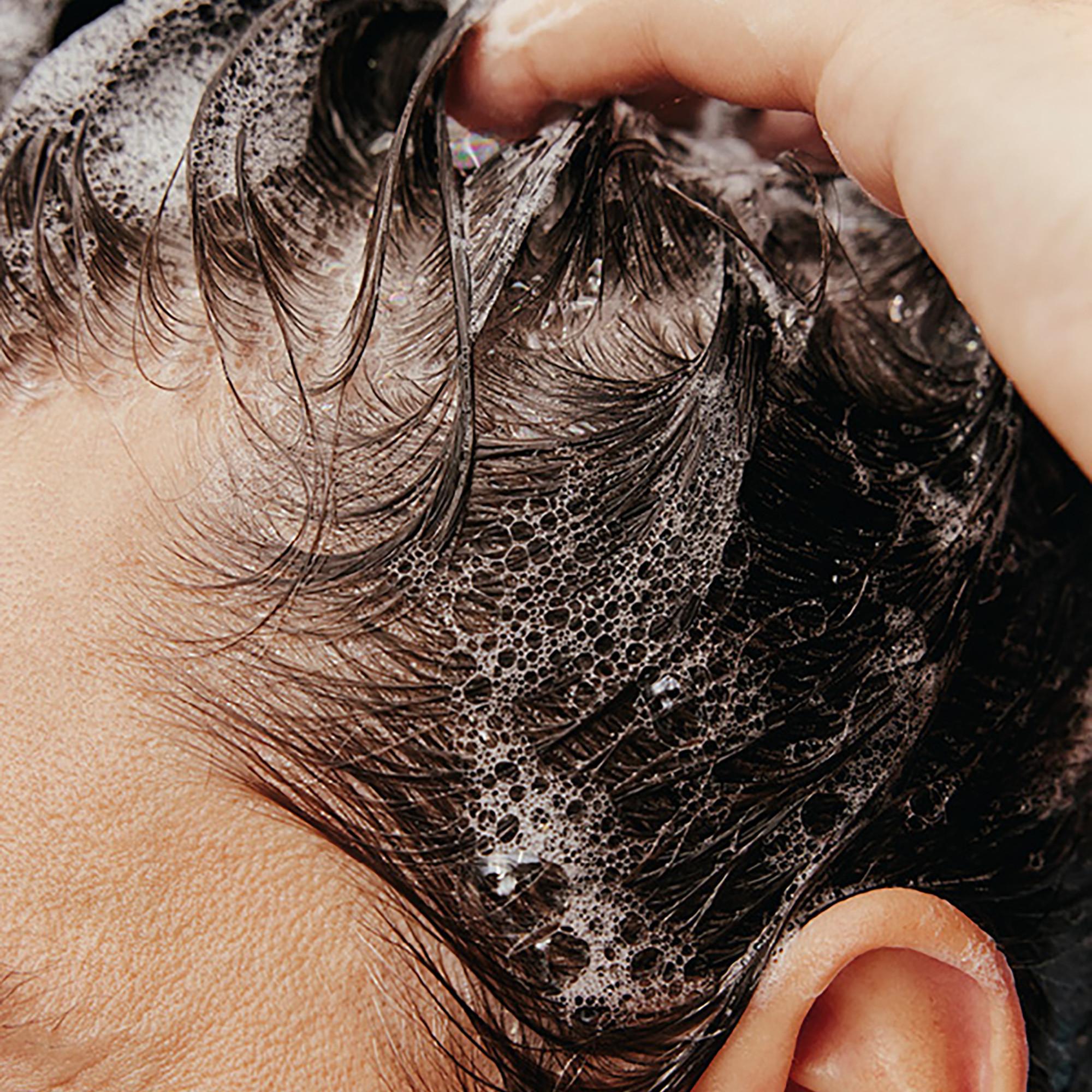 HORACE Gentle Anti-Dandruff Shampoo