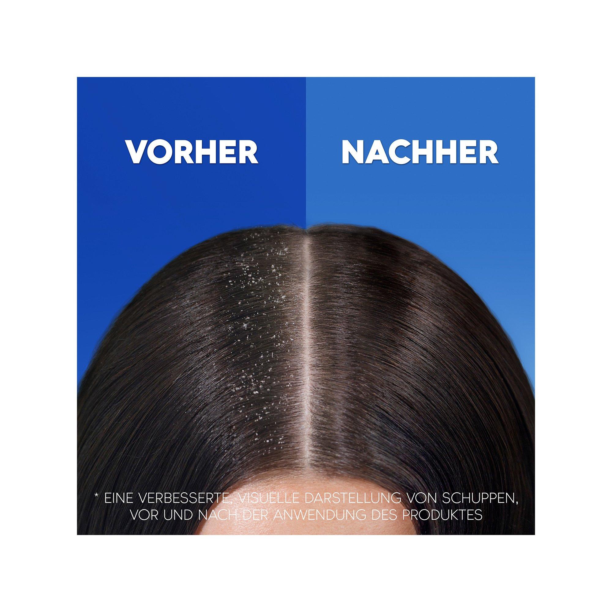 head & shoulders Anti-Haarverlust Anti-Schuppen-Shampoo