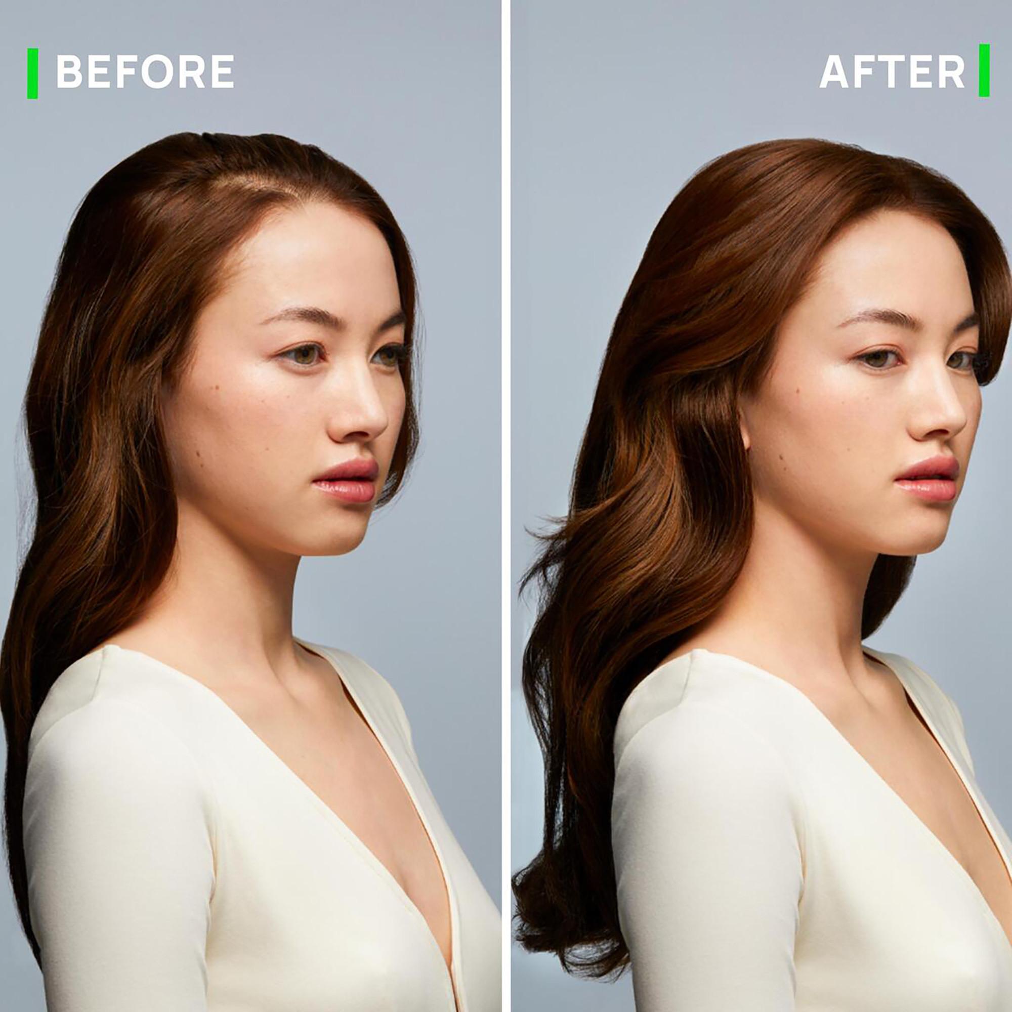 FURTERER Triphasic Shampoo bei Haarausfall