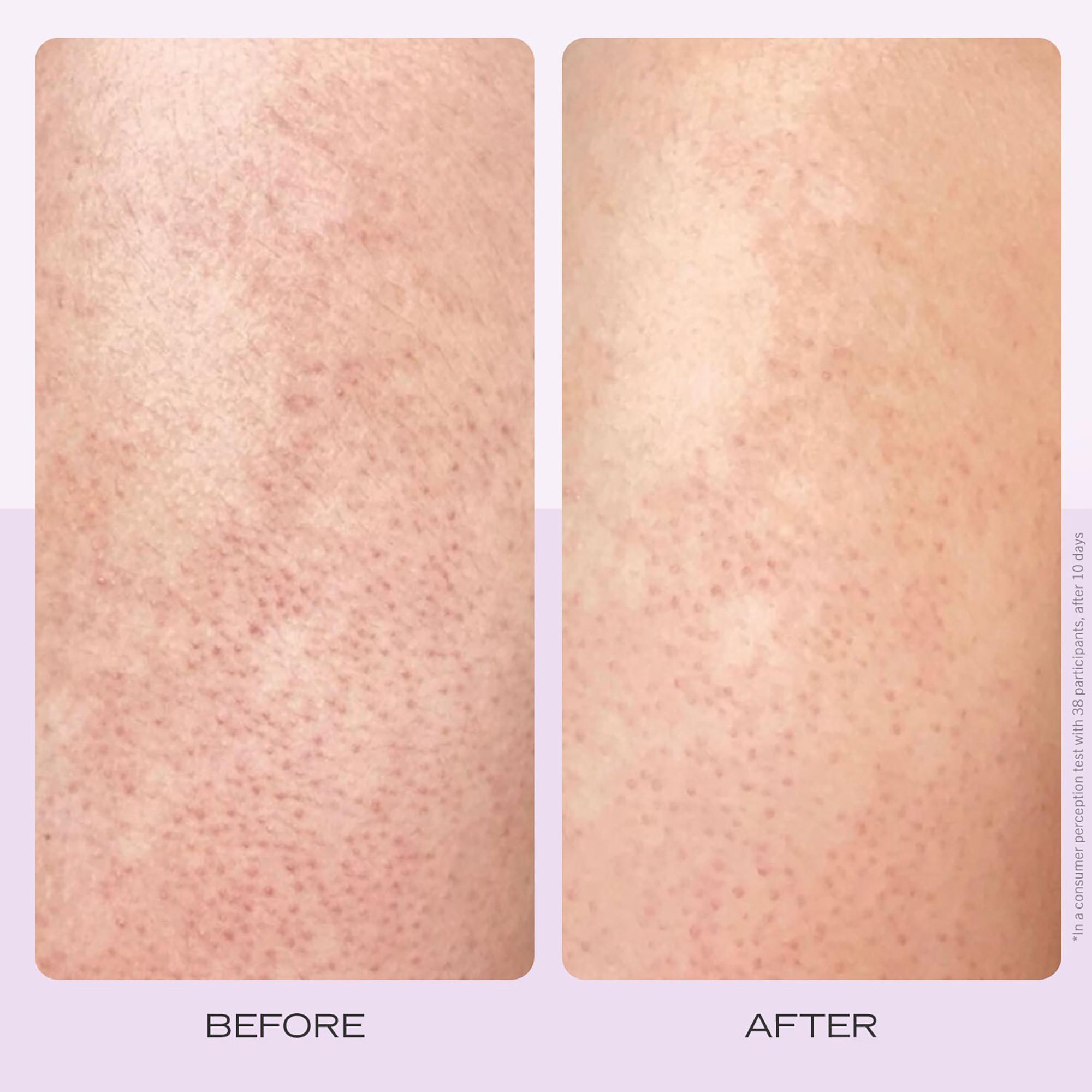 FIRST AID BEAUTY KP Body Scrub Strawberry - AHA-Körperpeeling mit Erdbeere für sofortige Zartheit