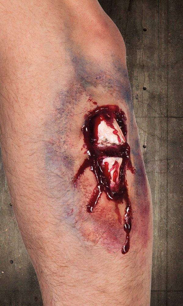 BOLAND Latexwunden, Zufallsauswahl