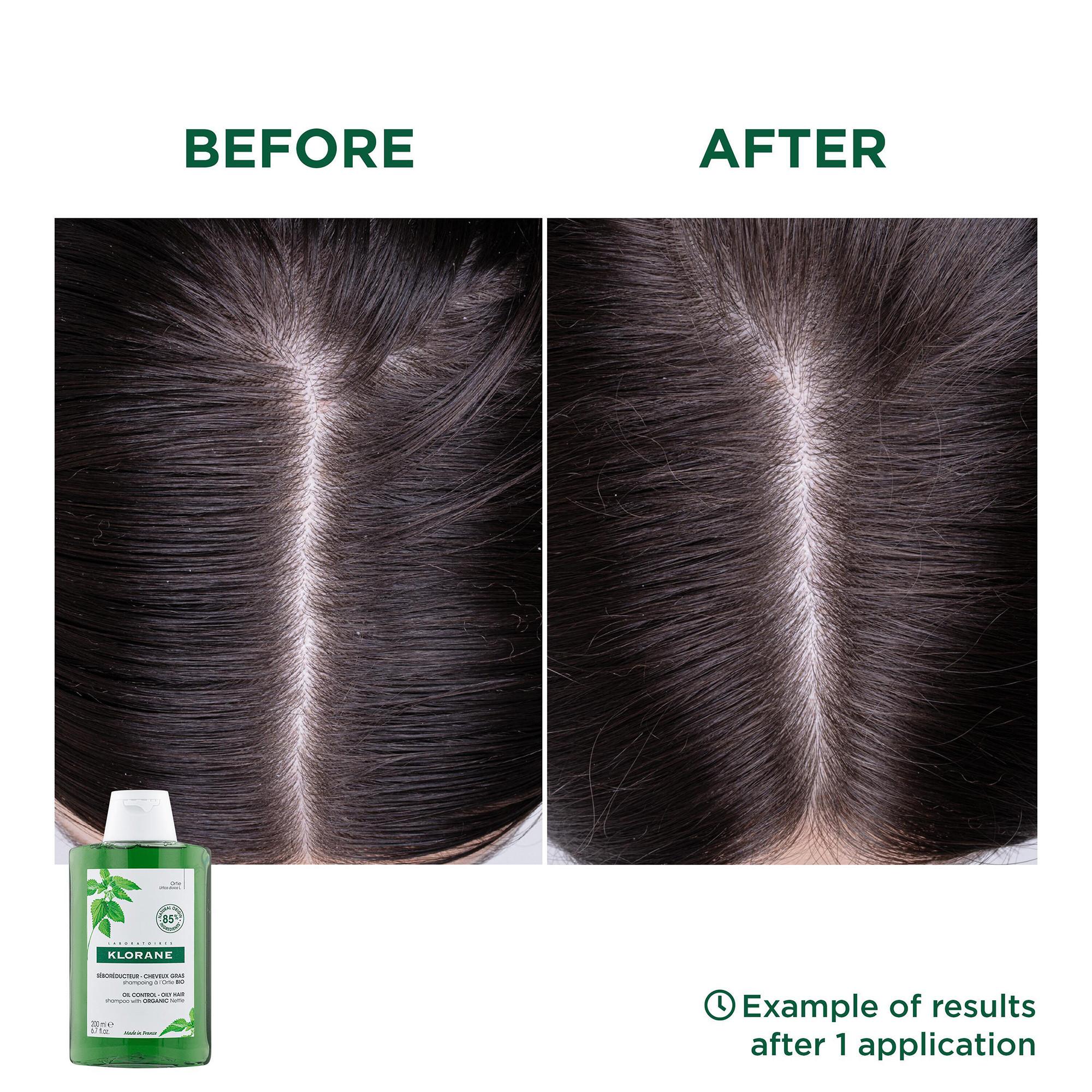 KLORANE BIO-Brennnessel Talgregulierendes Shampoo