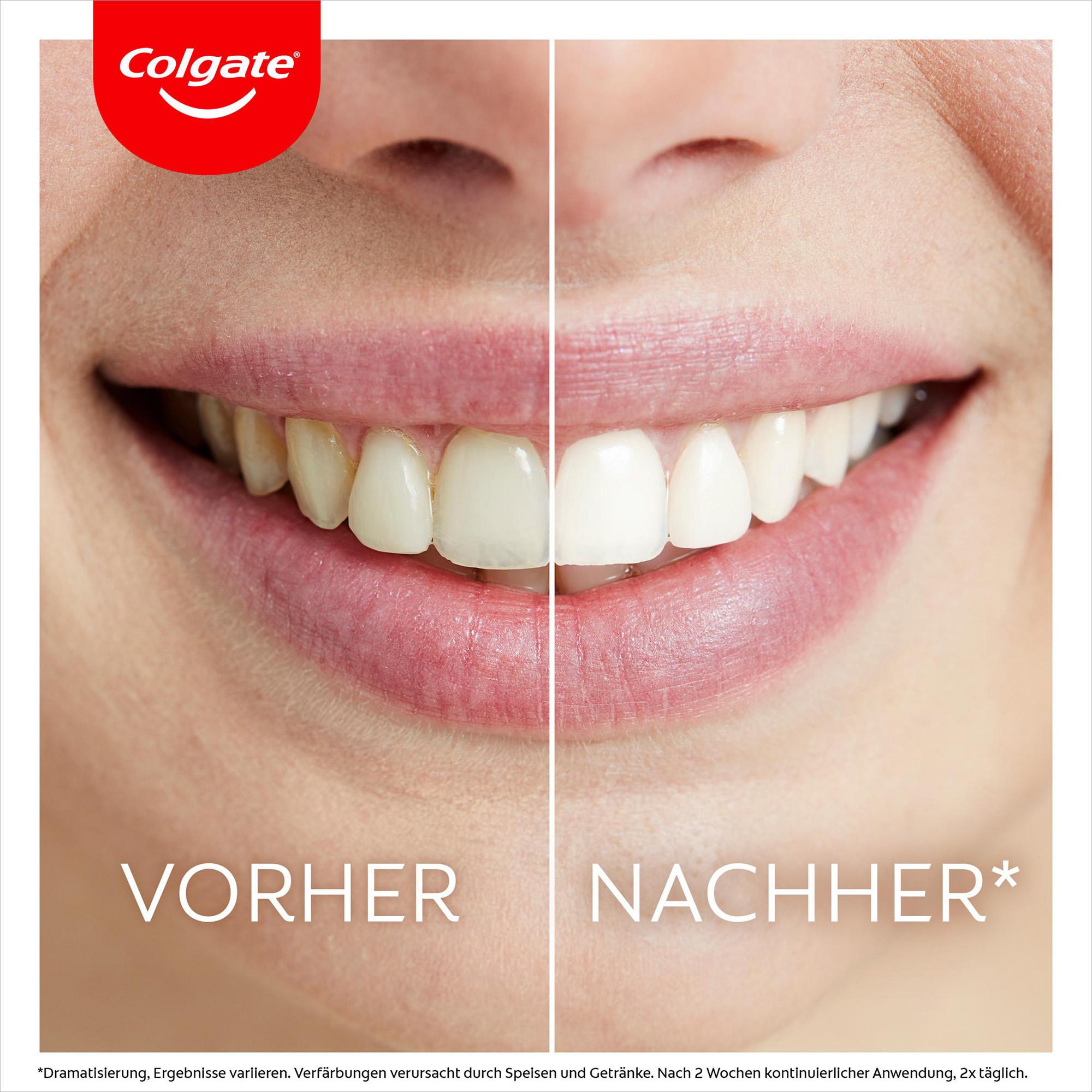 Colgate LED Whitening Kit Max White Ultimate