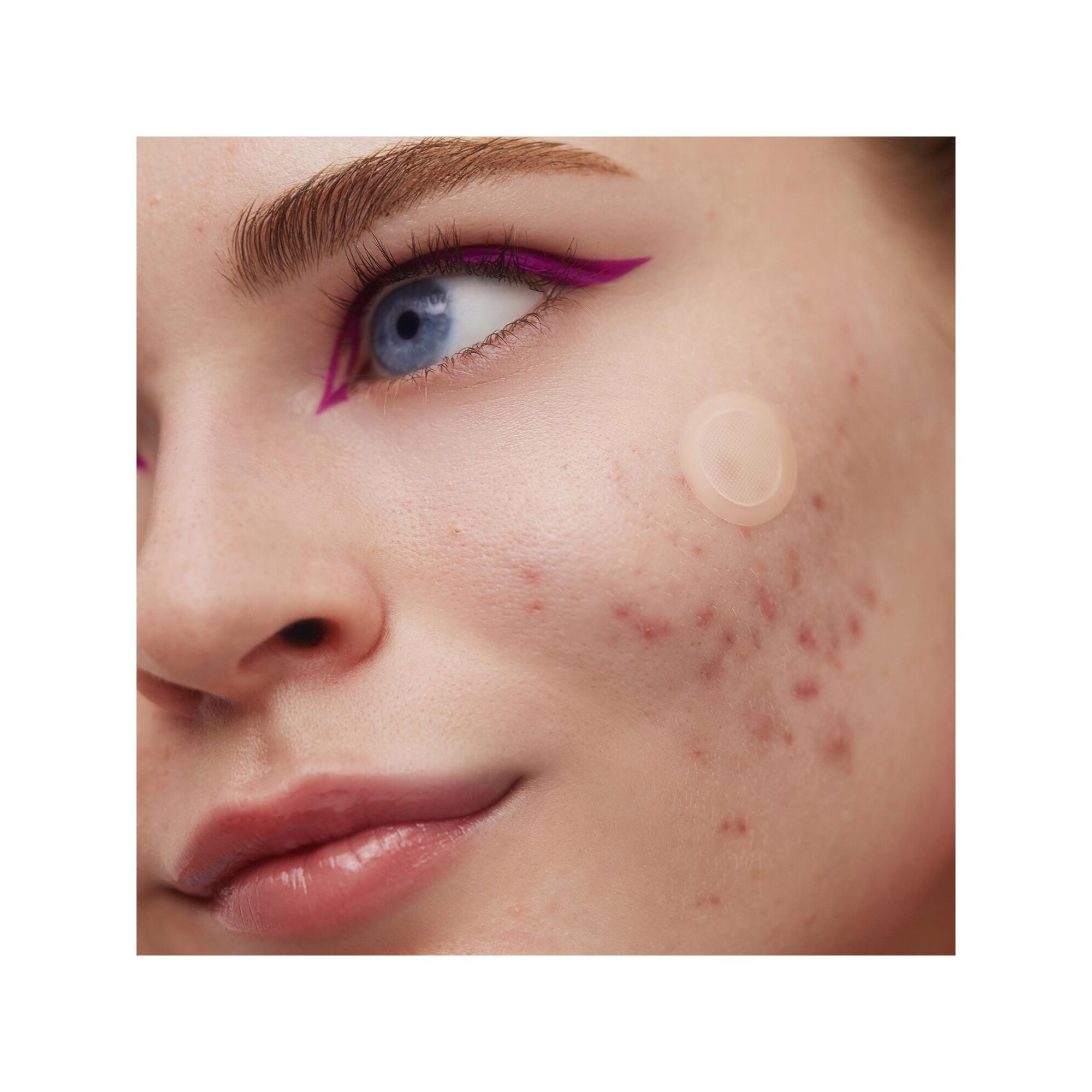 PEACE OUT SKINCARE Patches zur Aknebehandlung - Mikroperforation