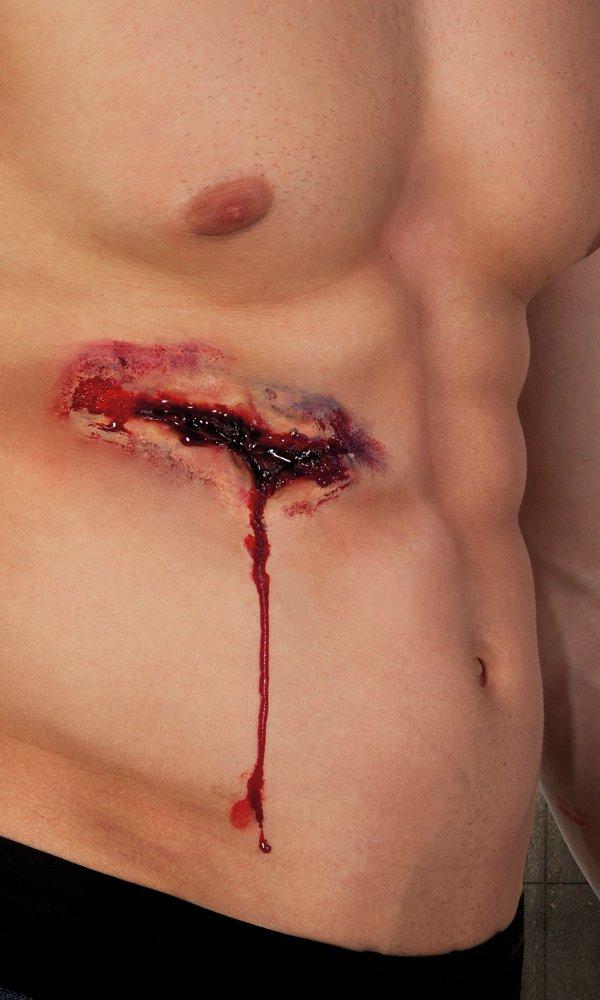 BOLAND Latexwunden, Zufallsauswahl